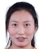 Xie Zongmei